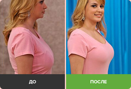 WowBra